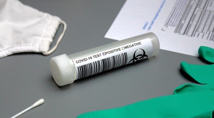 Test-rapido-Covid