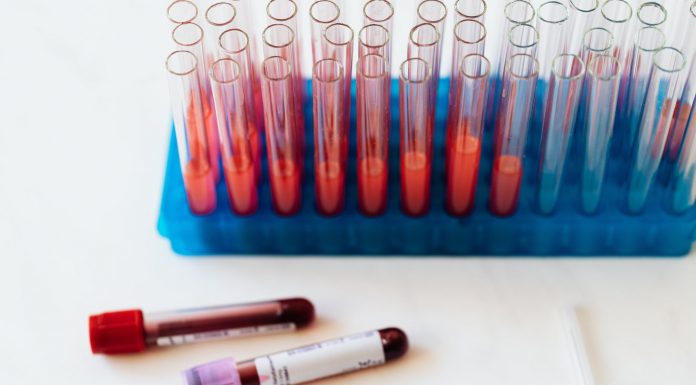 Test-sierologici-Covid